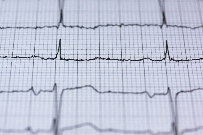 Wieviel Watt Sollte Man Beim Belastungs Ekg Schaffen Belastungs-EKG (Ergometrie): Ablauf, Auswertung, Watt-Tabelle