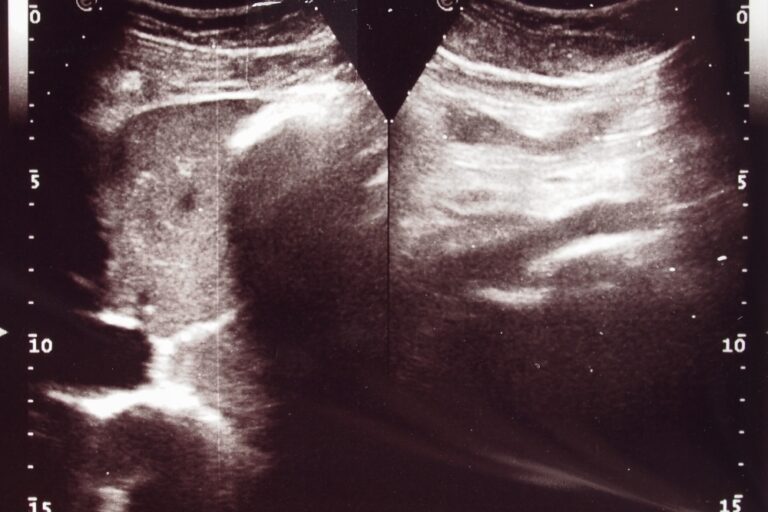 Wie Lange Vor Bauch Ultraschall Nichts Essen medizinio.de