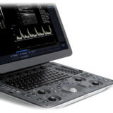 Sonoscape E1V Ultraschallgerät