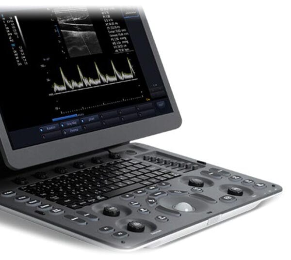 Sonoscape E1V Ultraschallgerät