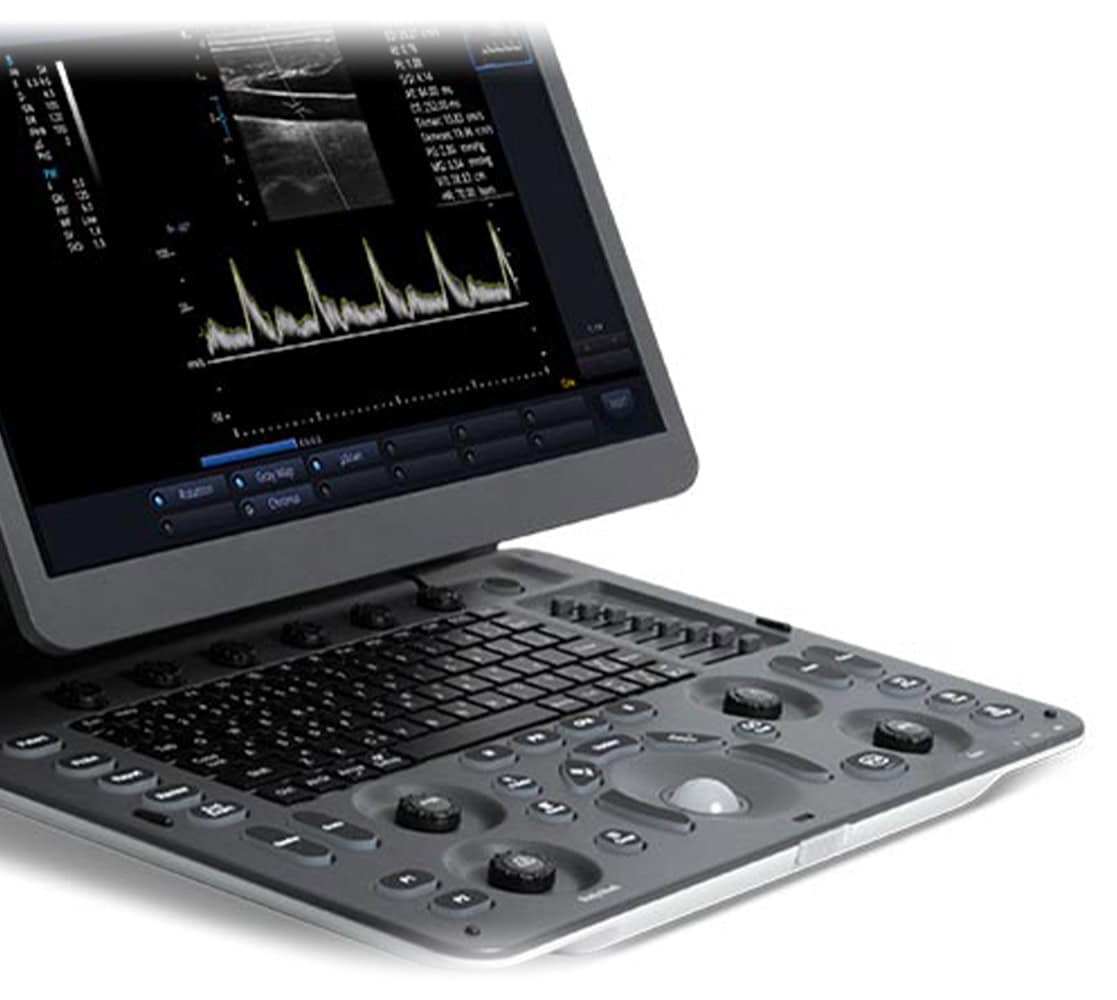 sonoscape-e1-vet-ultraschallgeraete-1 Sonoscape E1V Ultraschallgerät