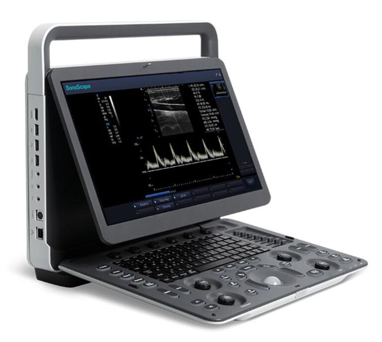 Sonoscape E1V Ultraschallgerät