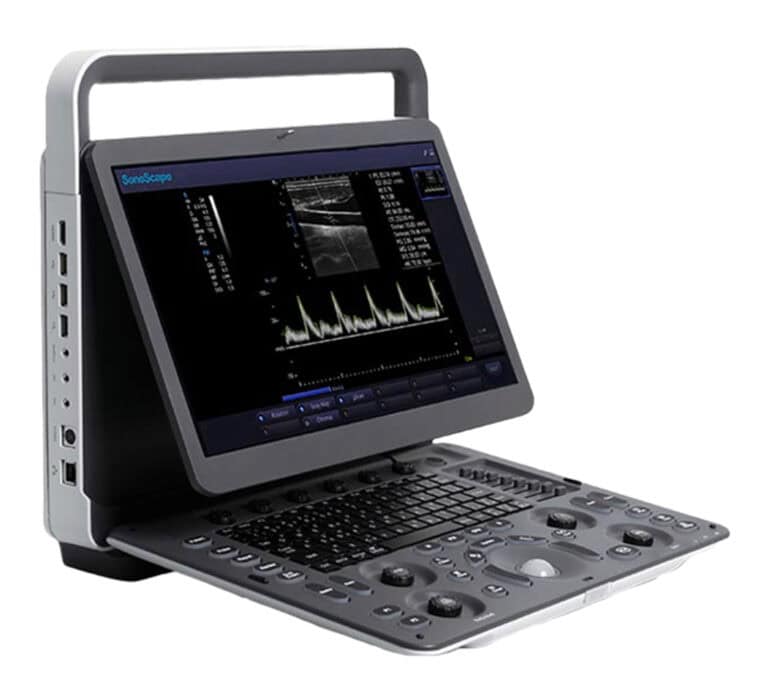 Sonoscape E2 Ultraschallgerät