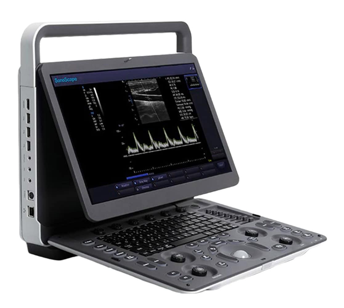 SonoScape E3 Ultraschallgerät