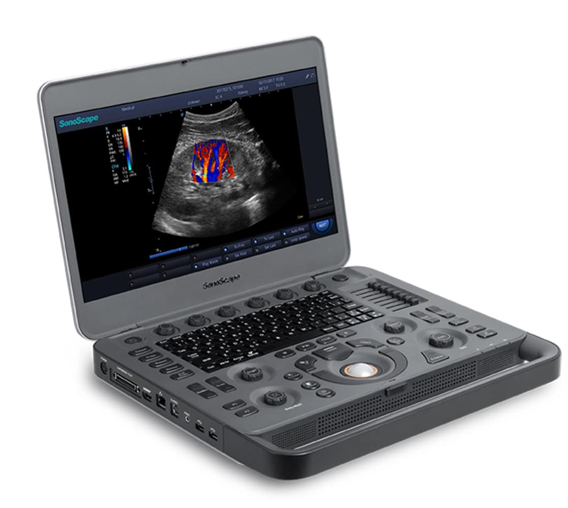 sonoscape-x3-vet-ultraschallgeraete SonoScape X3V Ultraschallgerät