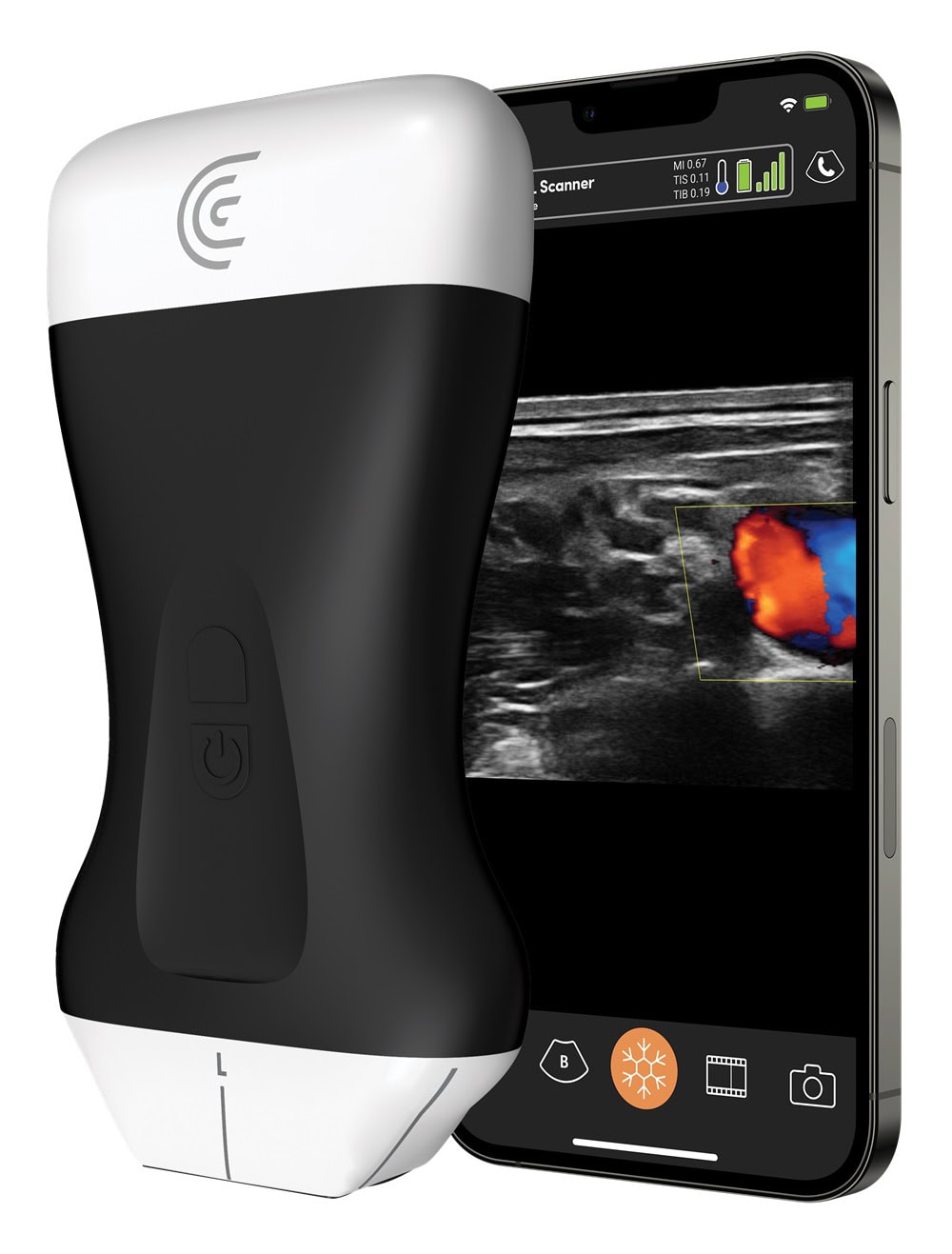 clarius-pal-hd3-anaesthesie Clarius PAL HD3 Anästhesie