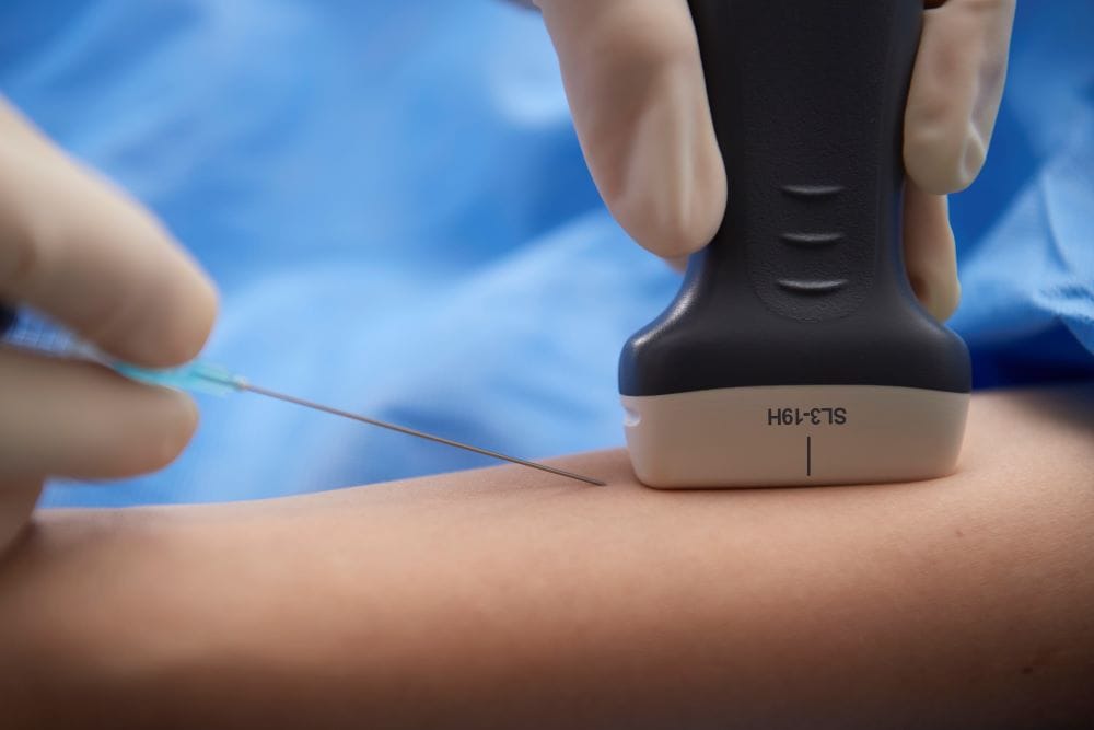 alpinion-x-cube-90-ultraschallgerät-1 Alpinion X-CUBE 90 Ultraschallgerät