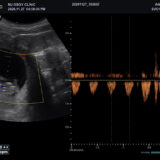 Alpinion X-CUBE 90 Ultraschallgerät Sonographie