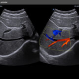 Alpinion X-CUBE i8 Ultraschallgerät Sonographie in Farbe
