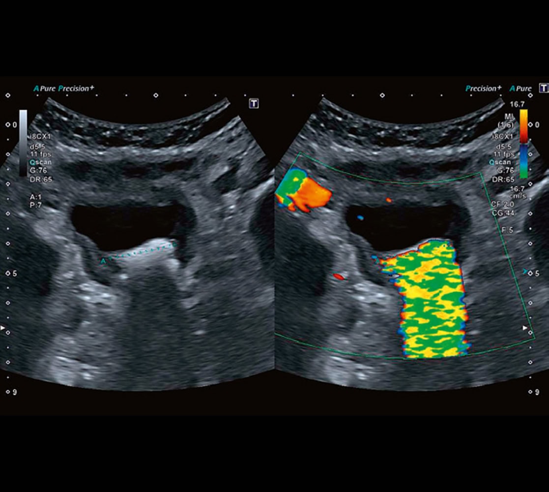 canon-aplio-a-uro-edition-ultraschallgeraete-7 Canon Aplio a Ultraschallgerät UroEdition