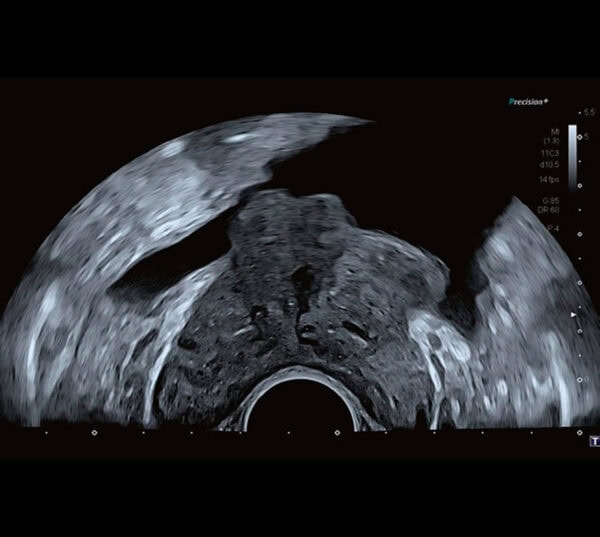 Canon Aplio a Ultraschallgerät UroEdition