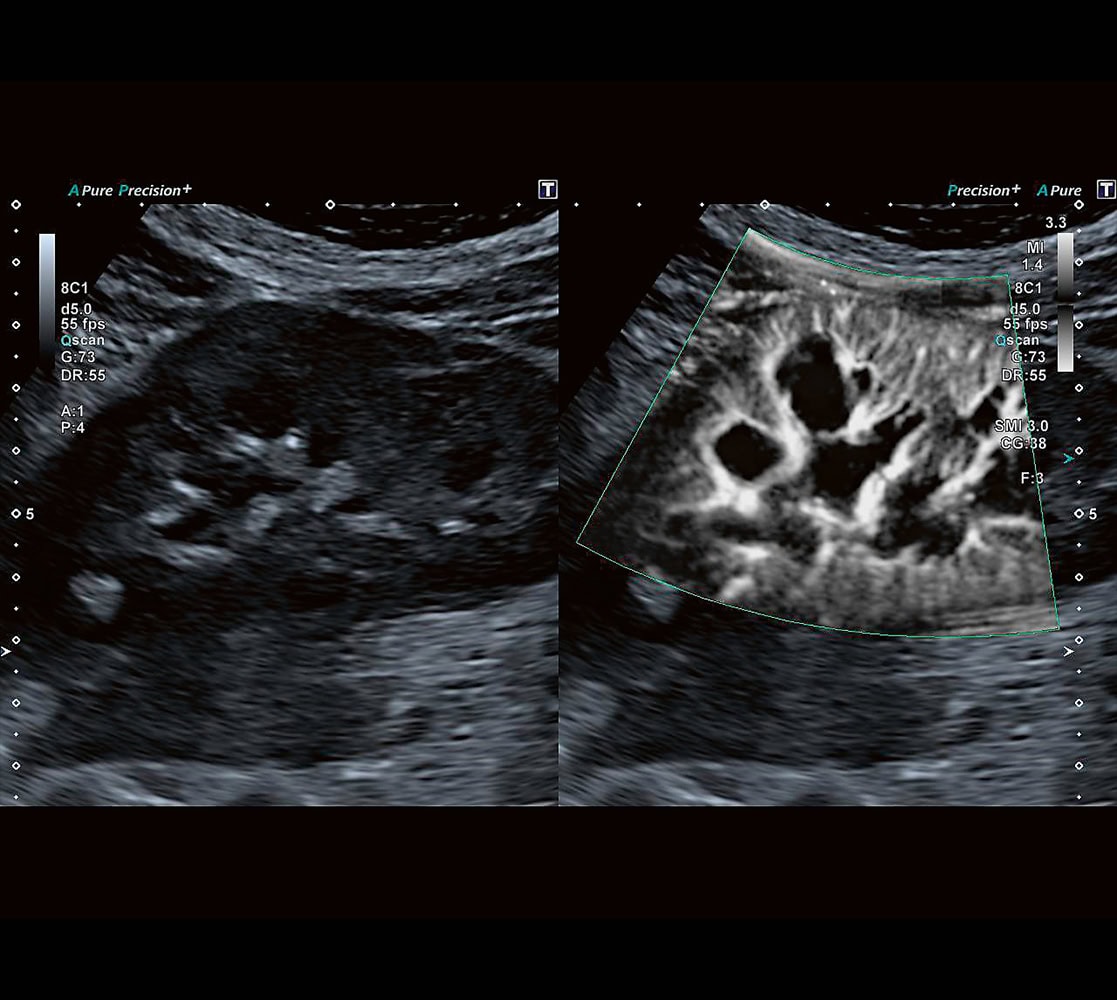 canon-aplio-a550-ultraschallgeraete-2 Canon Aplio a550 Ultraschallgerät