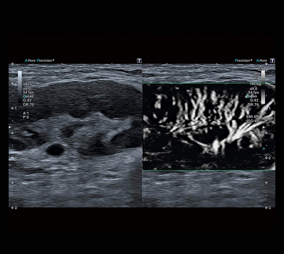 canon-aplio-a550-ultraschallgeraete-6 Canon Aplio a550 Ultraschallgerät