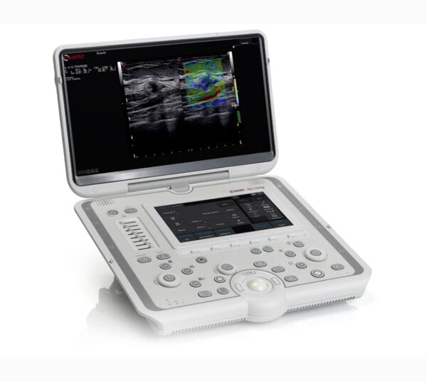 Esaote MyLab Omega Ultraschallgerät