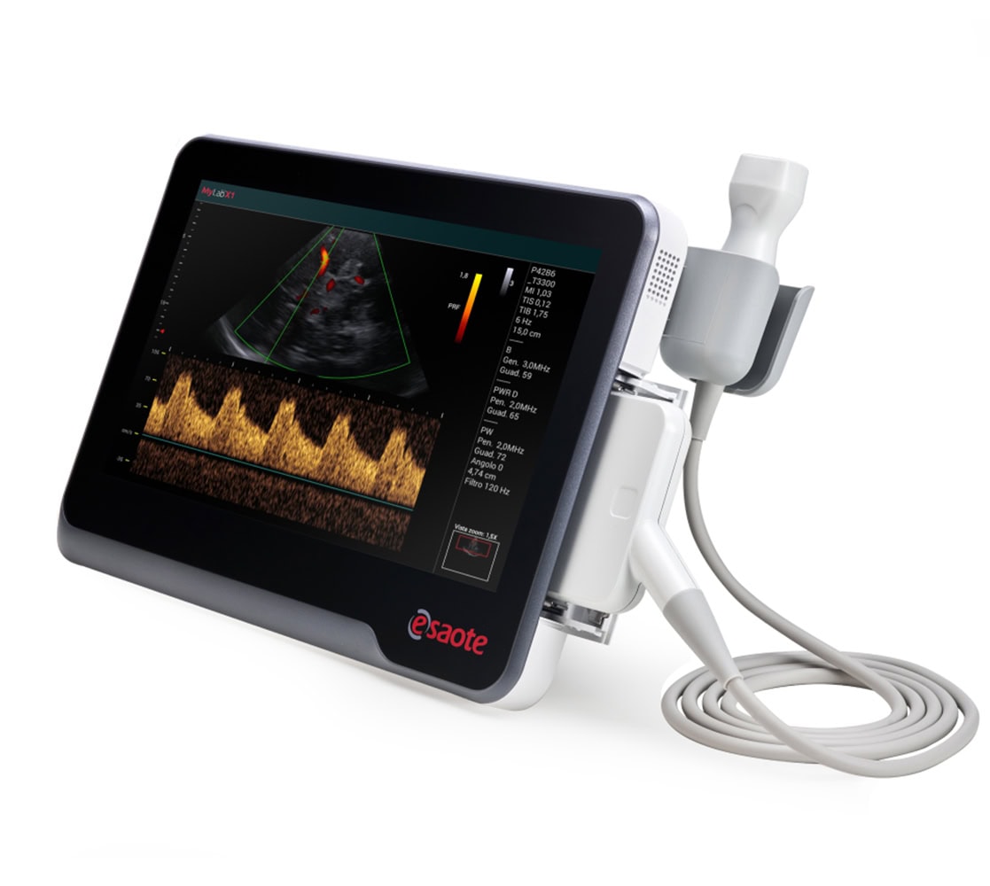Esaote MyLab X1 Ultraschallgerät