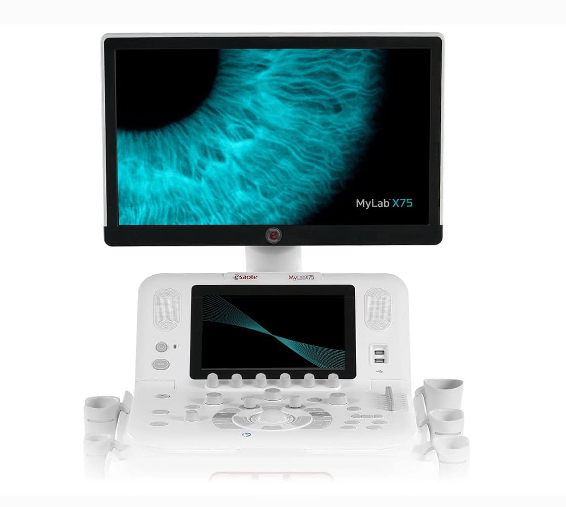 Esaote MyLab X75 Ultraschallgerät