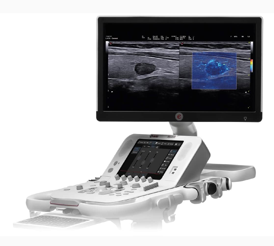 Esaote MyLab X8 Platform Ultraschallgerät