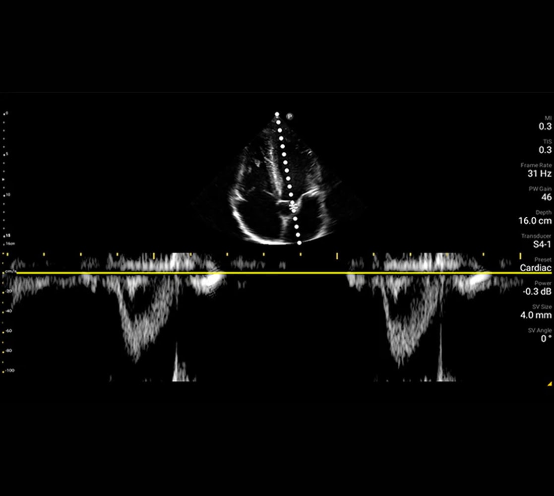 philips-lumify-ultraschallgeraete-2