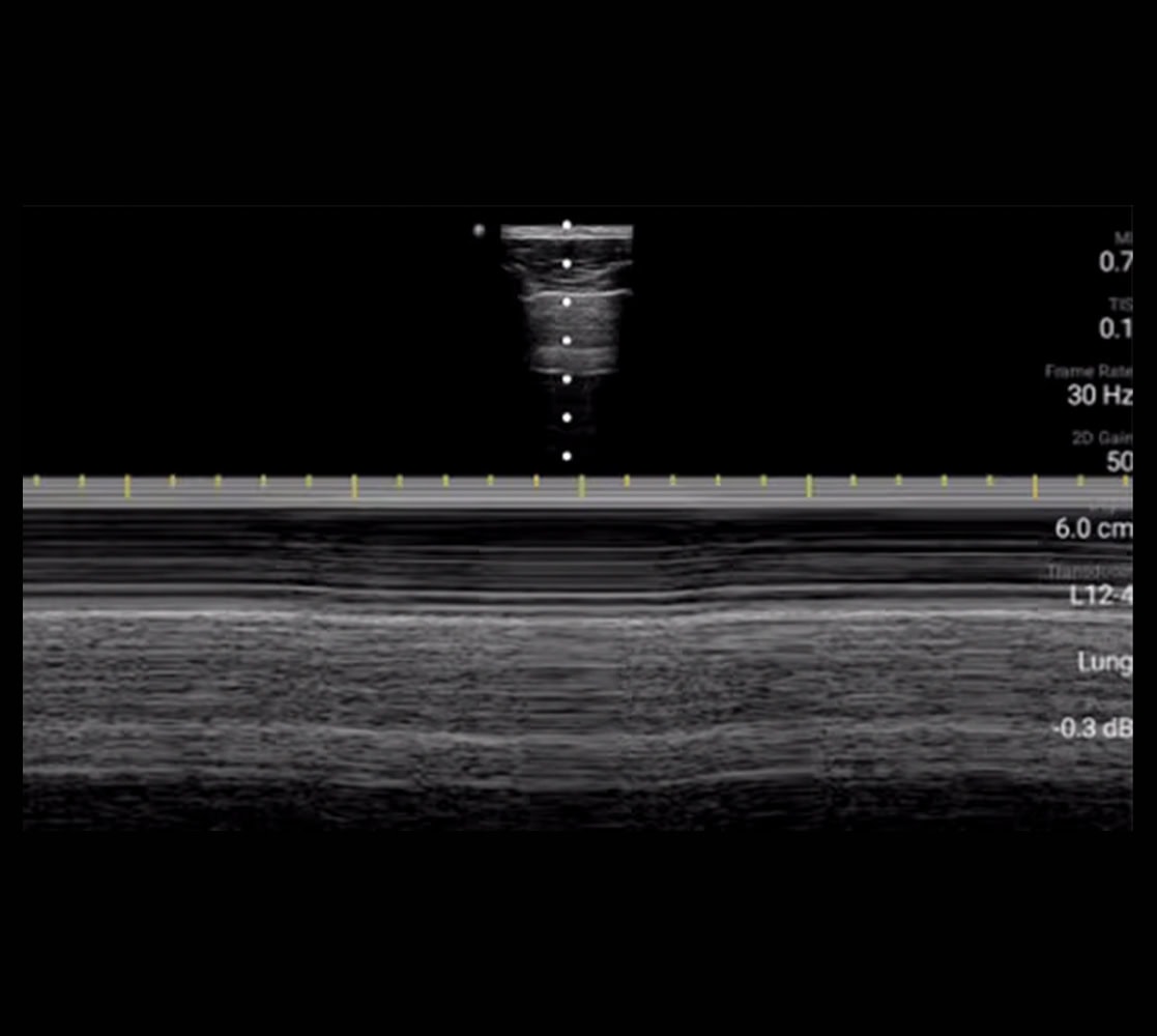 philips-lumify-ultraschallgeraete-5