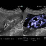 Fujifilm ARIETTA 650 DeepInsight Ultraschallgerät