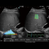 Fujifilm ARIETTA 650 DeepInsight Ultraschallgerät