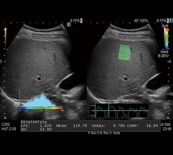 Fujifilm ARIETTA 650 DeepInsight Ultraschallgerät