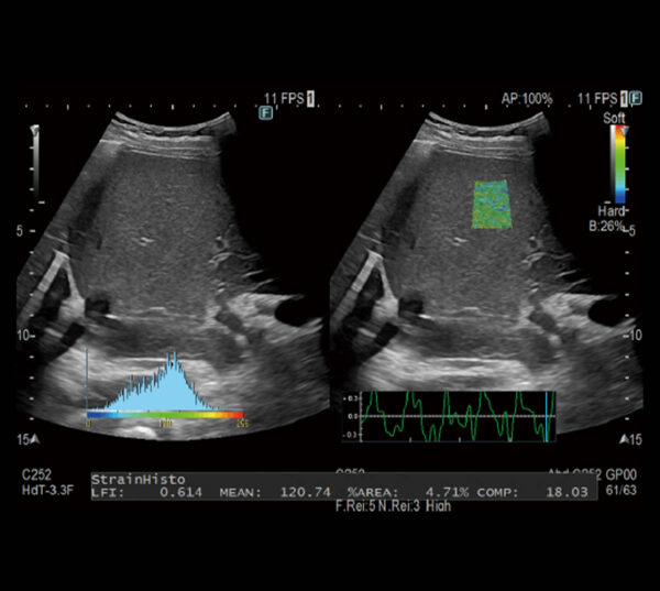 Fujifilm ARIETTA 750 DeepInsight Ultraschallgerät