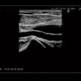 Fujifilm ARIETTA 850 DeepInsight Ultraschallgerät