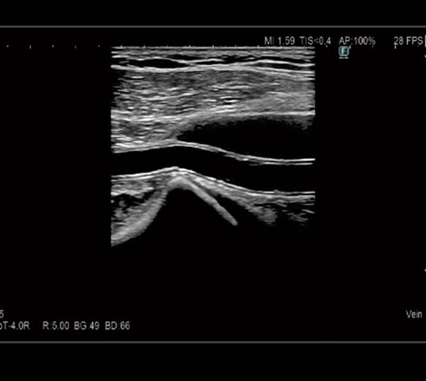 Fujifilm ARIETTA 850 DeepInsight Ultraschallgerät