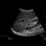 Fujifilm SonoSite LX Ultraschallgerät