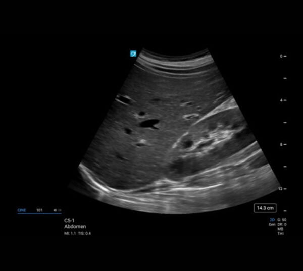 Fujifilm SonoSite LX Ultraschallgerät