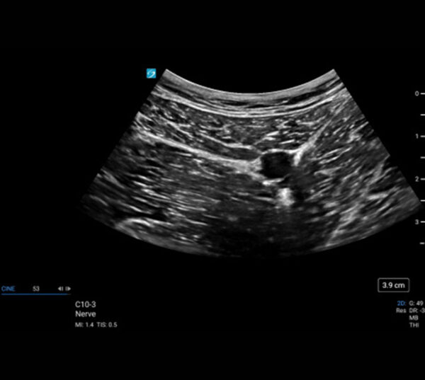 Fujifilm SonoSite LX Ultraschallgerät