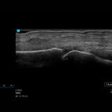 Fujifilm SonoSite LX Ultraschallgerät