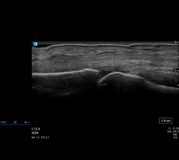 Fujifilm SonoSite LX Ultraschallgerät