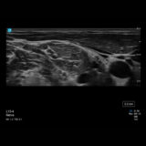 Fujifilm SonoSite PX Ultraschallgerät