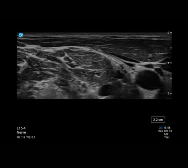 Fujifilm SonoSite PX Ultraschallgerät