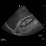 Fujifilm SonoSite PX Ultraschallgerät