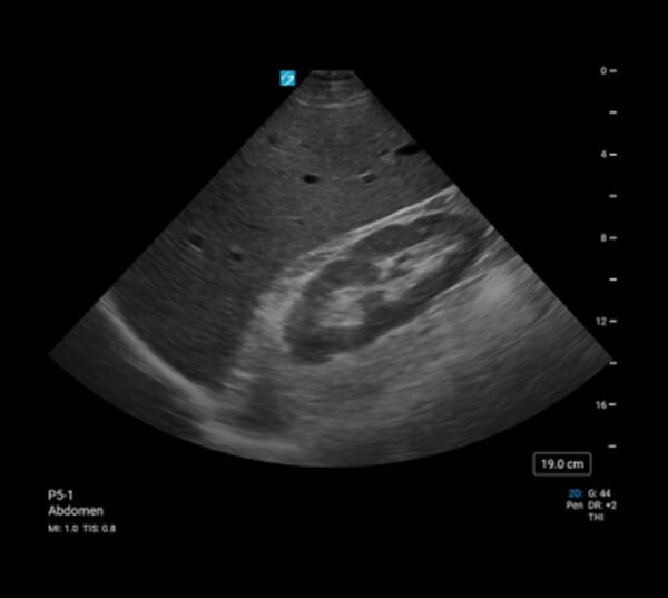 Fujifilm SonoSite PX Ultraschallgerät