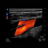 Fujifilm SonoSite PX Ultraschallgerät