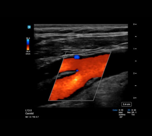 Fujifilm SonoSite PX Ultraschallgerät