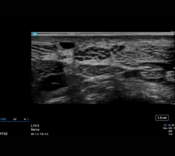 Fujifilm SonoSite PX Ultraschallgerät