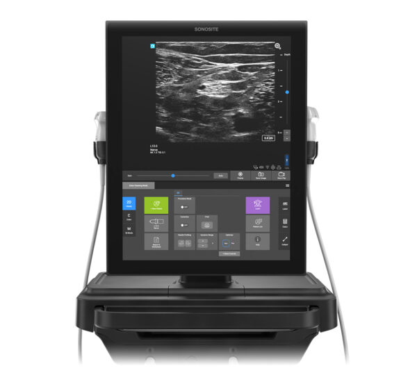 Fujifilm SonoSite ST Ultraschallgerät