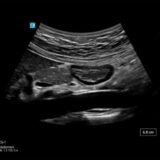 Fujifilm SonoSite ST Ultraschallgerät