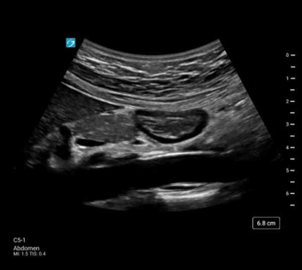 Fujifilm SonoSite ST Ultraschallgerät