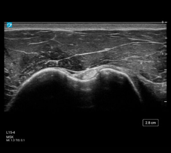 Fujifilm SonoSite ST Ultraschallgerät