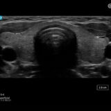 Fujifilm SonoSite ST Ultraschallgerät