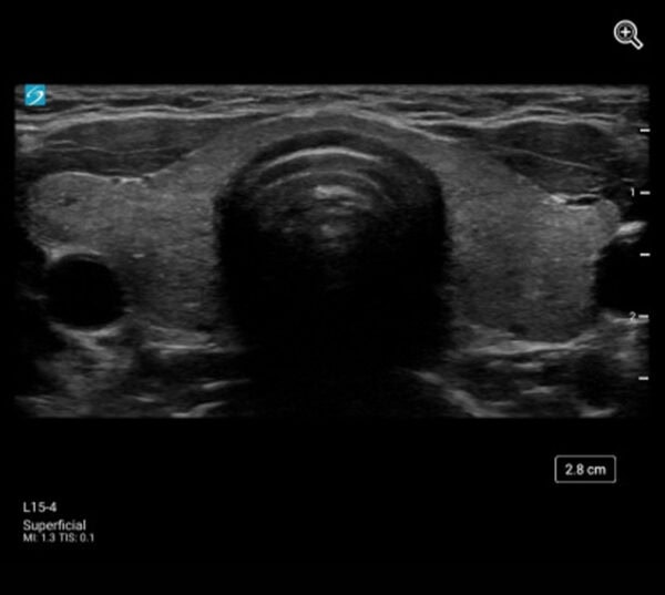 Fujifilm SonoSite ST Ultraschallgerät