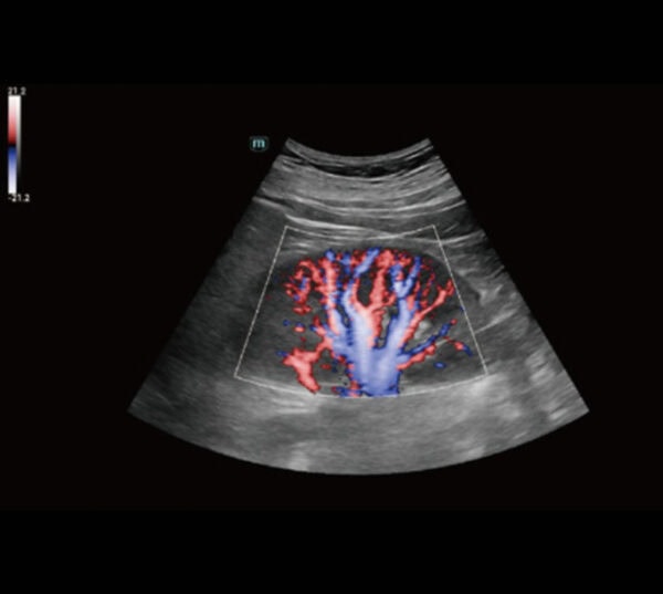 Mindray Consona N8 Ultraschallgerät