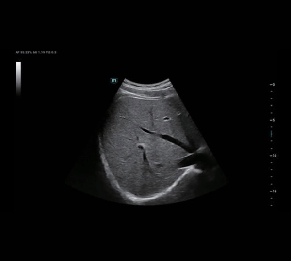 Mindray Consona N8 Ultraschallgerät