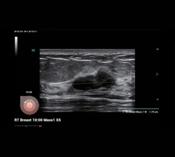 Mindray Consona N8 Ultraschallgerät